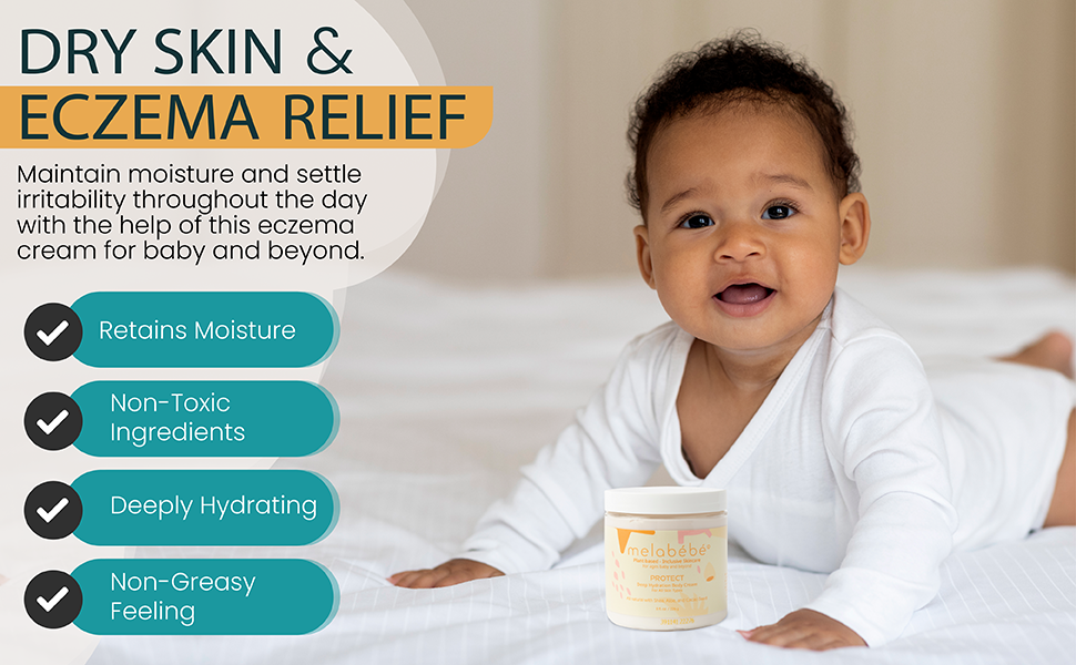 Dry Skin and Eczema Cream for Babies Melabebe