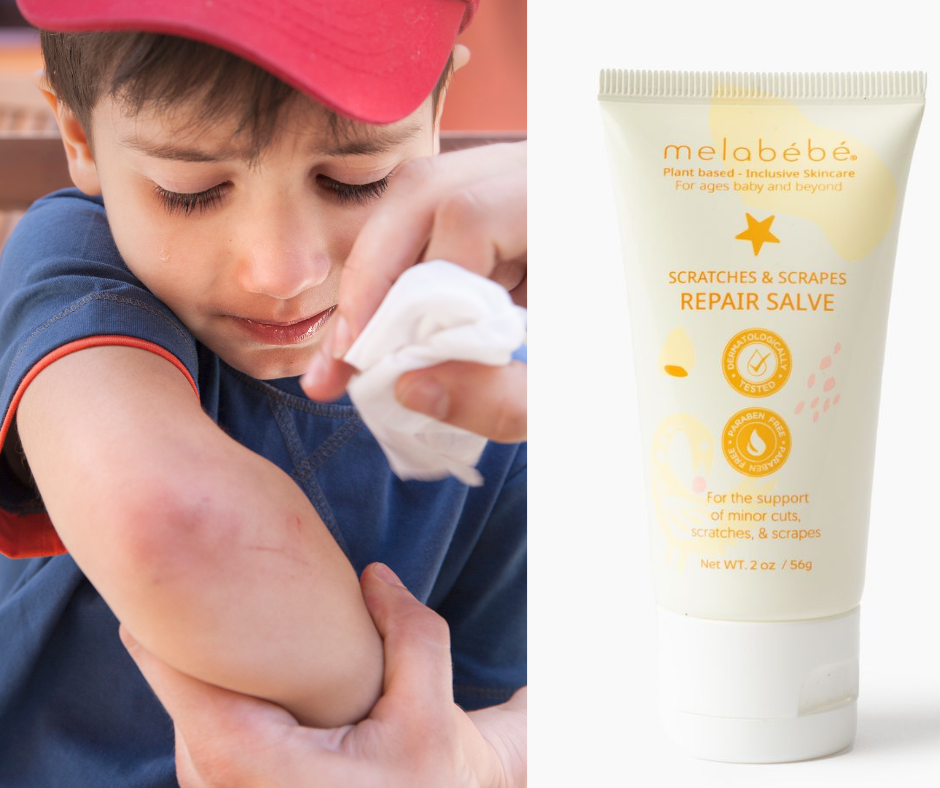 Melabebe Scratches & Scrapes Repair Salve